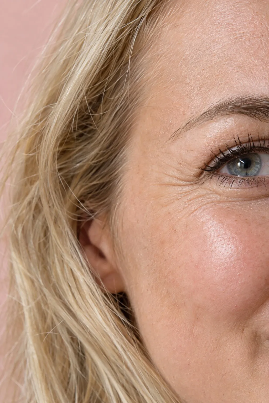 Editorial portrait for Crow’s Feet, Dr Harry Clinic