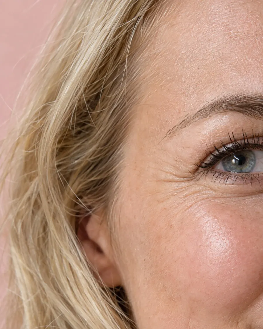 Editorial portrait for Crow’s Feet, Dr Harry Clinic