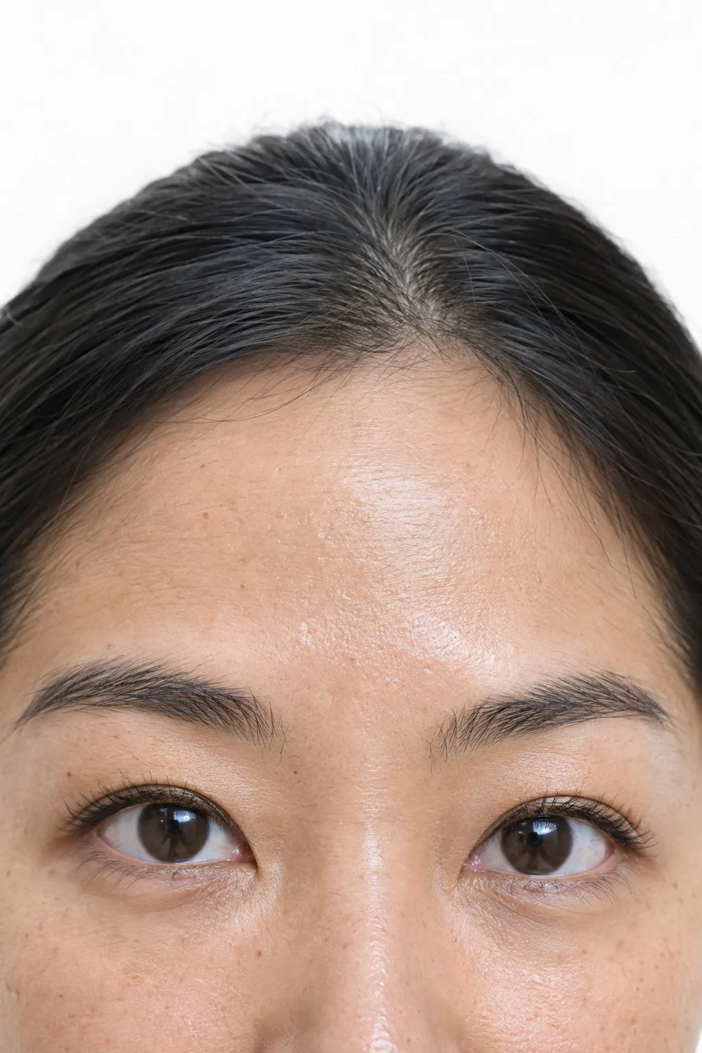 Editorial portrait for Frown Lines, Dr Harry Clinic