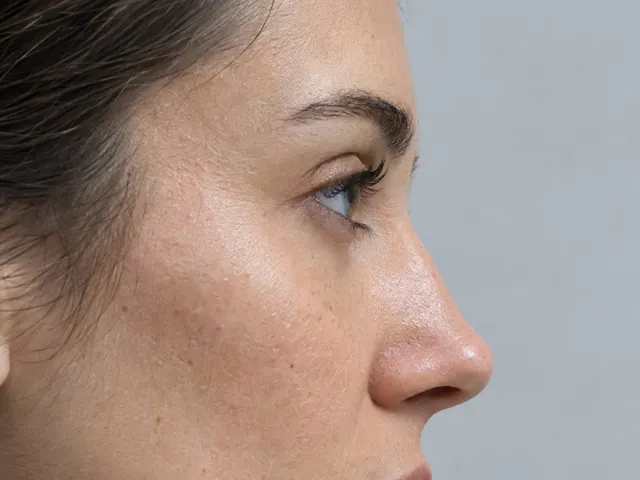 Editorial portrait for Nose Tip Lifting, Dr Harry Clinic