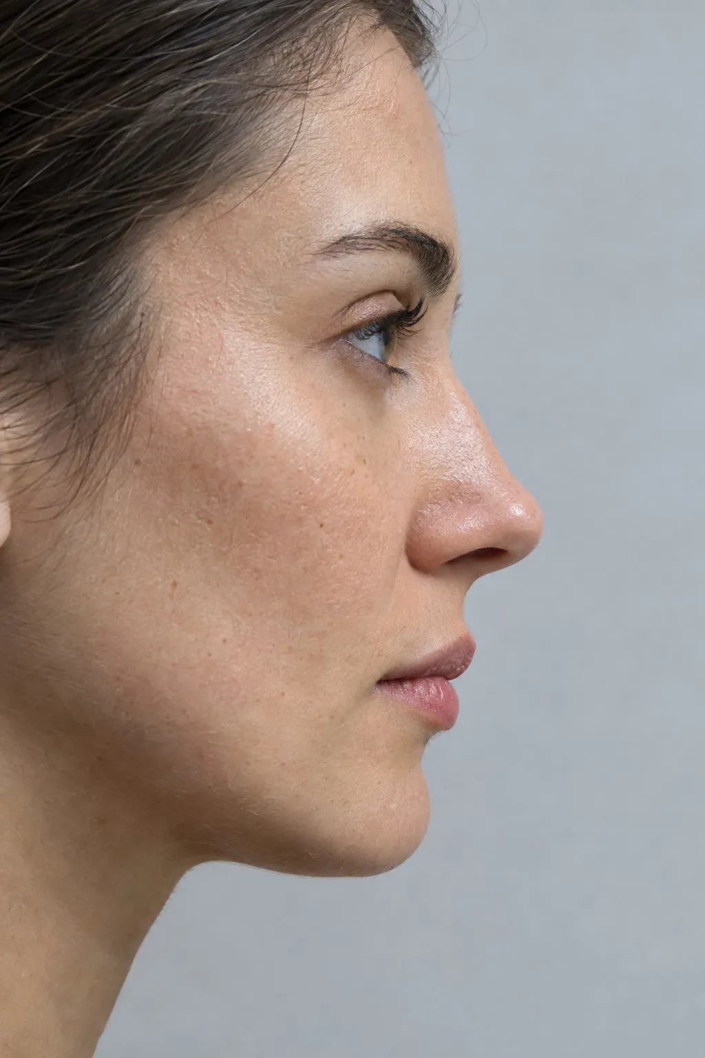 Editorial portrait for Nose Tip Lifting, Dr Harry Clinic