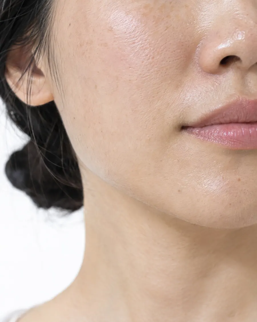 Editorial portrait for Marionette Lines, Dr Harry Clinic
