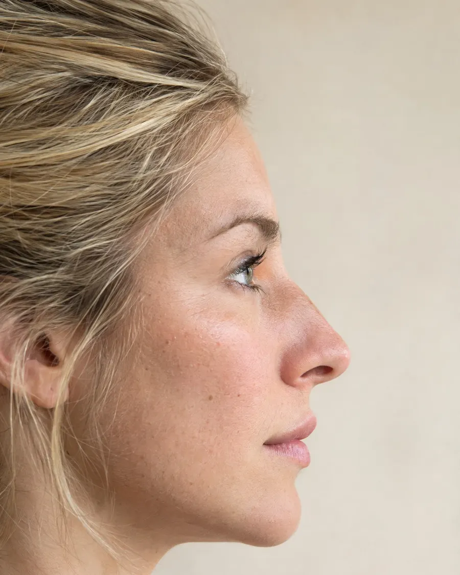 Editorial portrait for Nose, Dr Harry Clinic