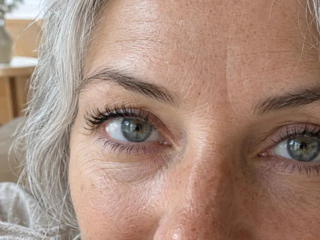 Editorial portrait for Eyes & Tear Trough, Dr Harry Clinic