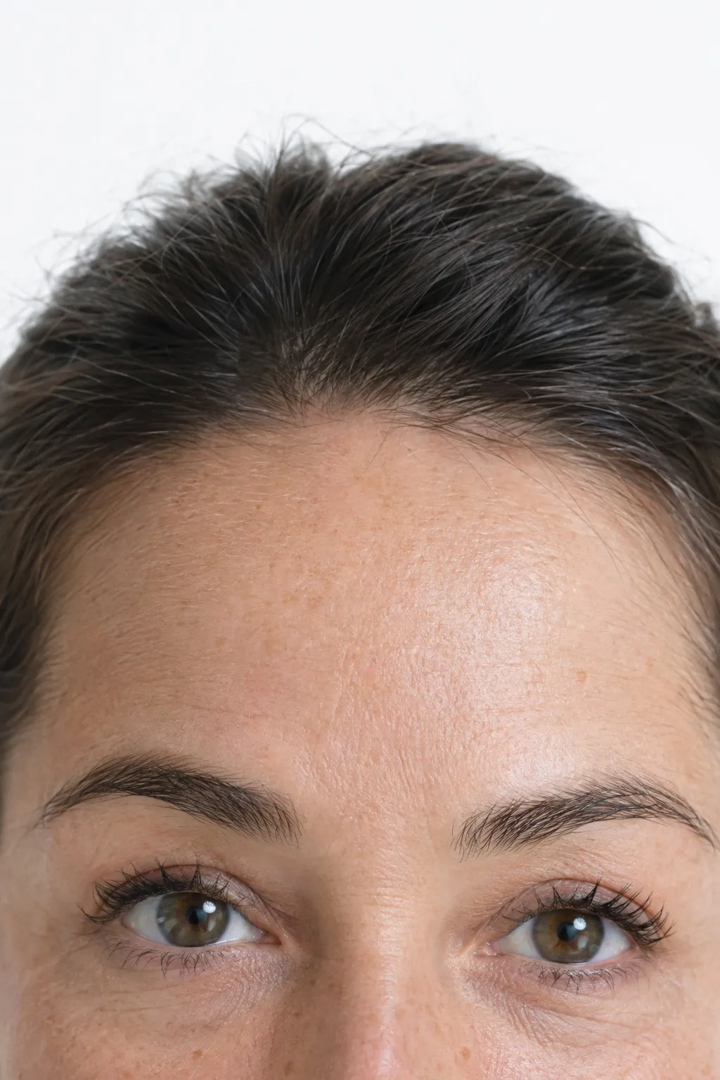 Editorial portrait for Forehead and Brow, Dr Harry Clinic
