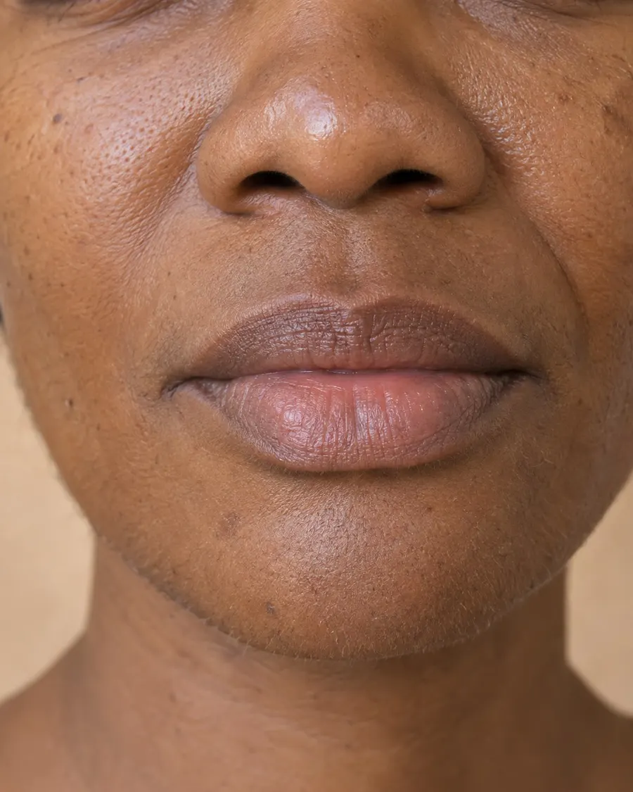 Editorial portrait for Lips & Perioral, Dr Harry Clinic