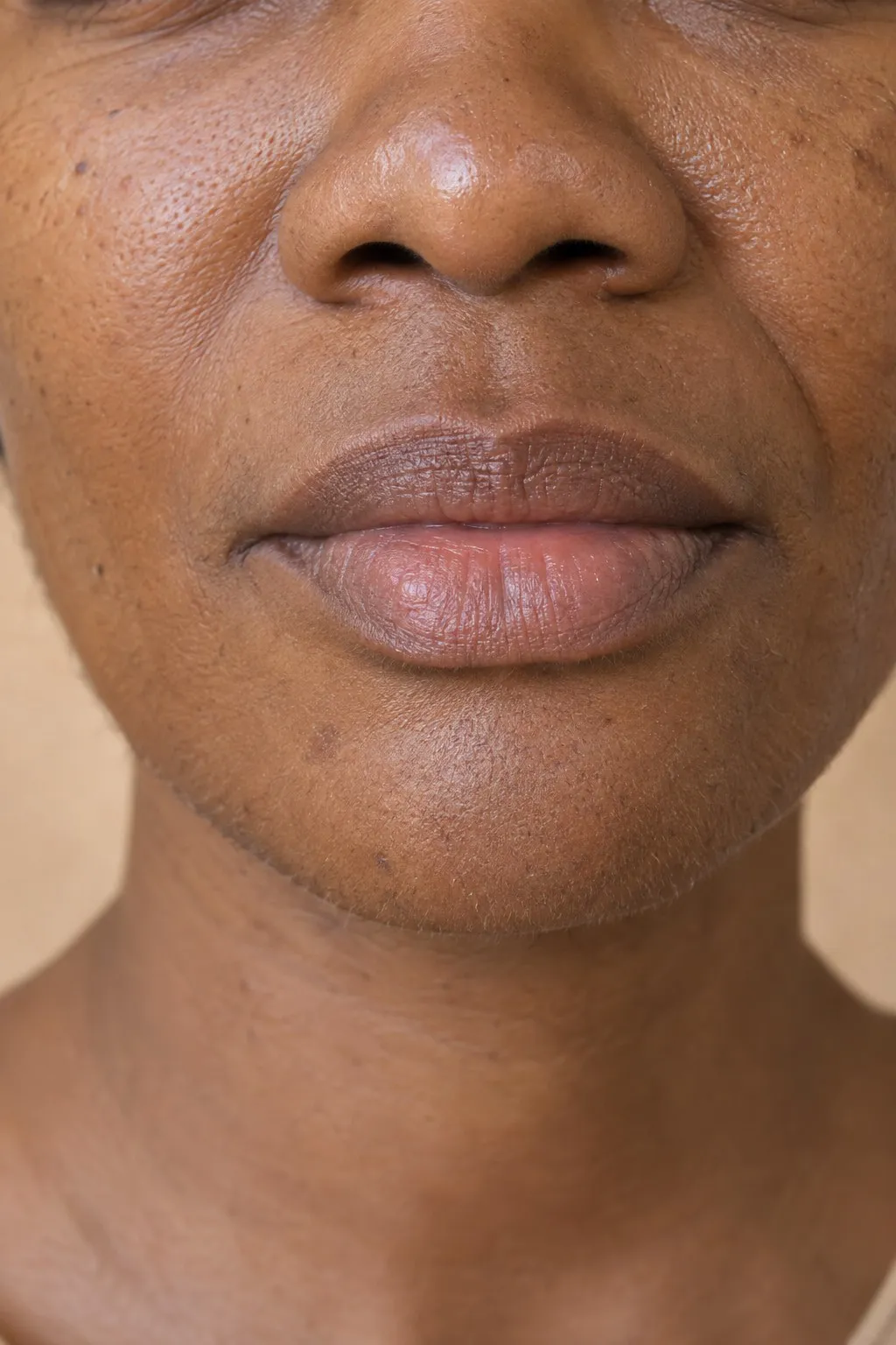 Editorial portrait for Lips & Perioral, Dr Harry Clinic