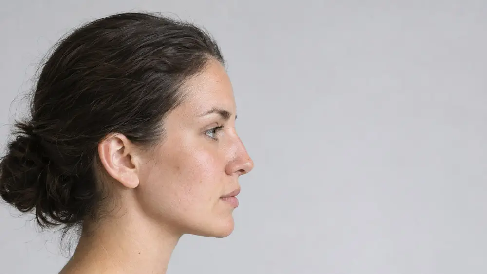 Editorial portrait for Filler Dissolving: How It Works, What It Costs and When Not To, Dr Harry Clinic