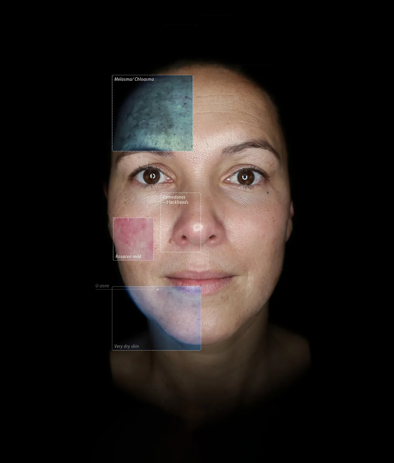 A face photographed by the Observ 520x, with the areas each light mode reveals marked