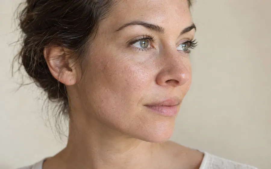 Weak jawline definition, shown on the face