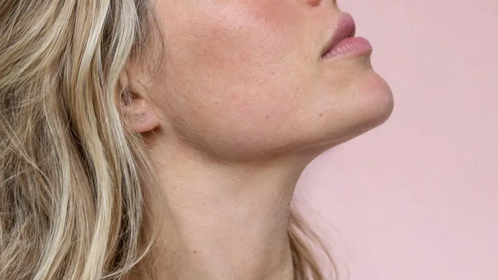 Editorial portrait for Nefertiti Neck Lift: Technique and Results, Dr Harry Clinic