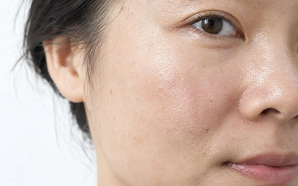 Editorial portrait for Profhilo vs. Traditional Fillers: Understanding the Differences, Dr Harry Clinic