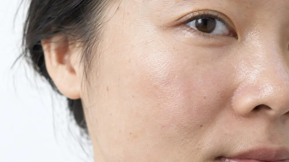 Editorial portrait for Profhilo vs. Traditional Fillers: Understanding the Differences, Dr Harry Clinic