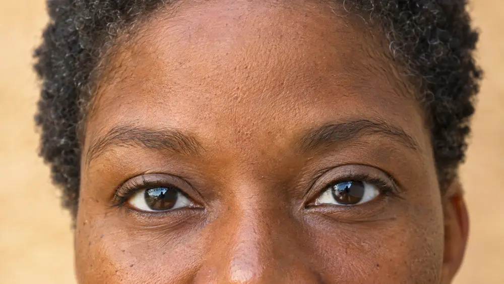 Editorial portrait for The Complete Guide to Anti-Wrinkle Injections: Types, Areas & Results, Dr Harry Clinic