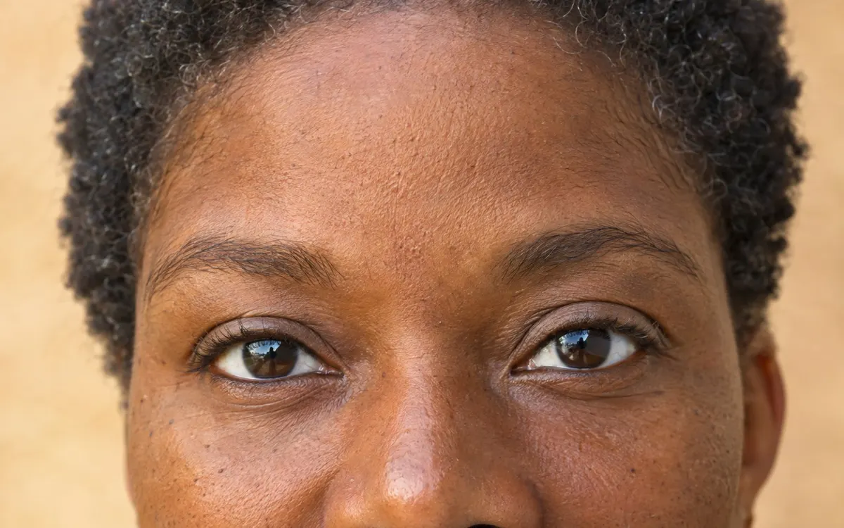 Editorial portrait for The Complete Guide to Anti-Wrinkle Injections: Types, Areas & Results, Dr Harry Clinic